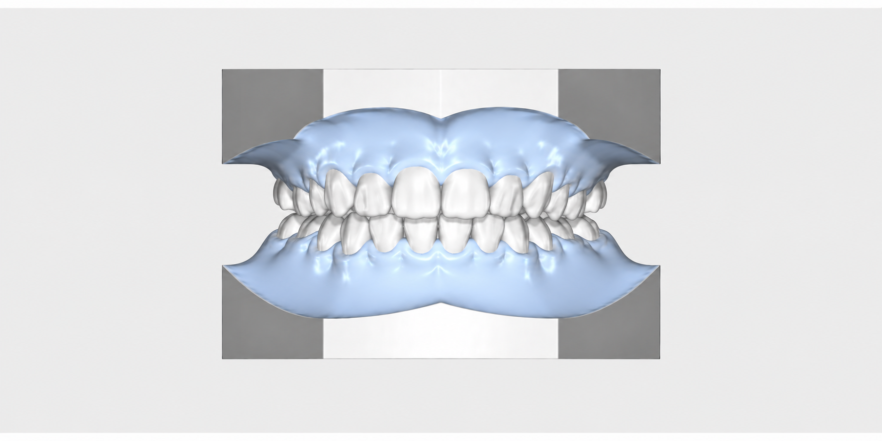 3D-Darstellung eines ausgerichteten Zahnmodells als beispielhafte Situation nach einer kieferorthopädischen Behandlung