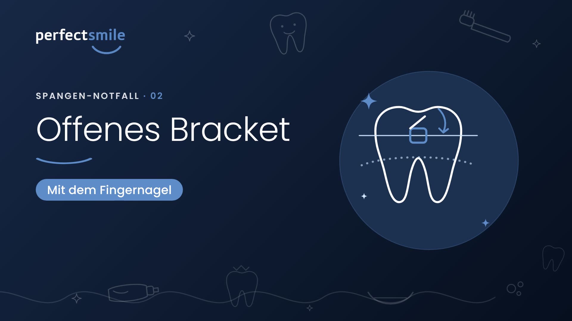 Vorschaubild: Offenes Bracket